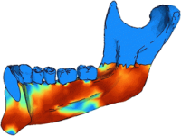 bone density